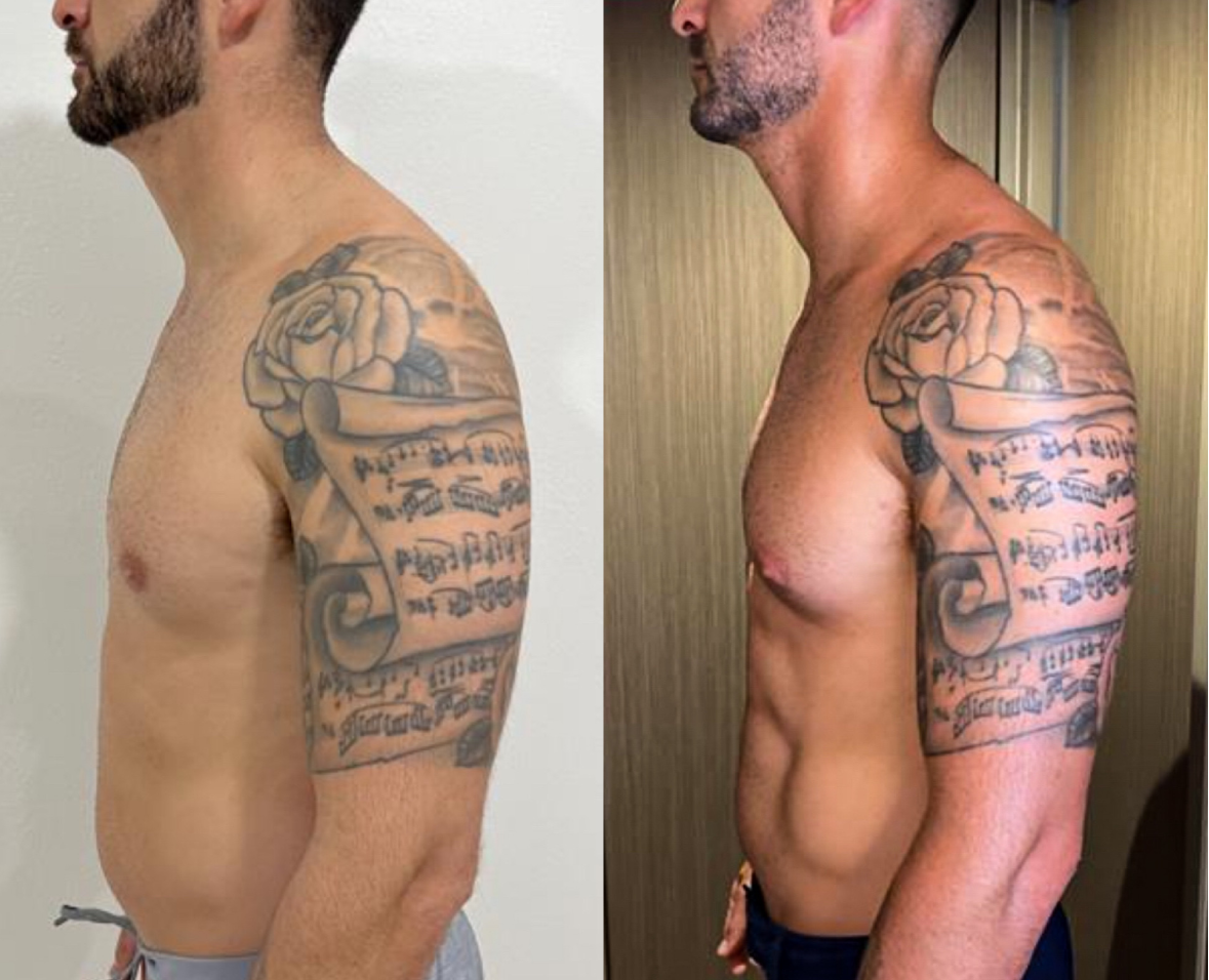 Tattooed man before and after body transformation.